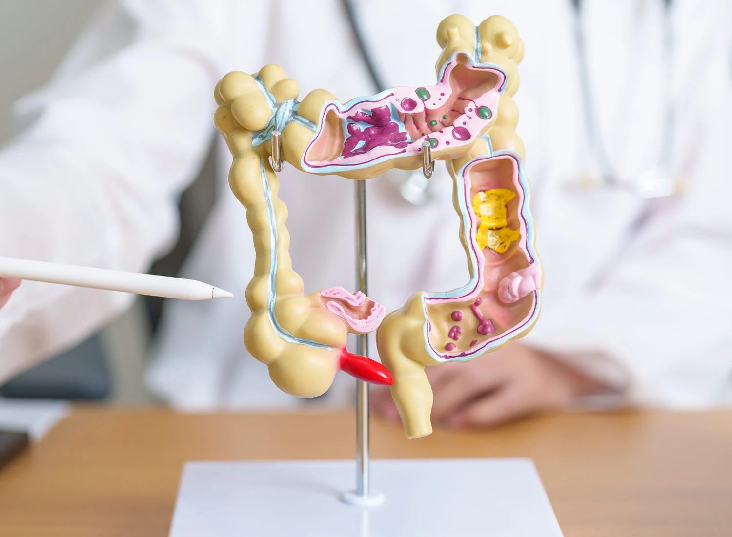 doctor pointing to gastro tract model