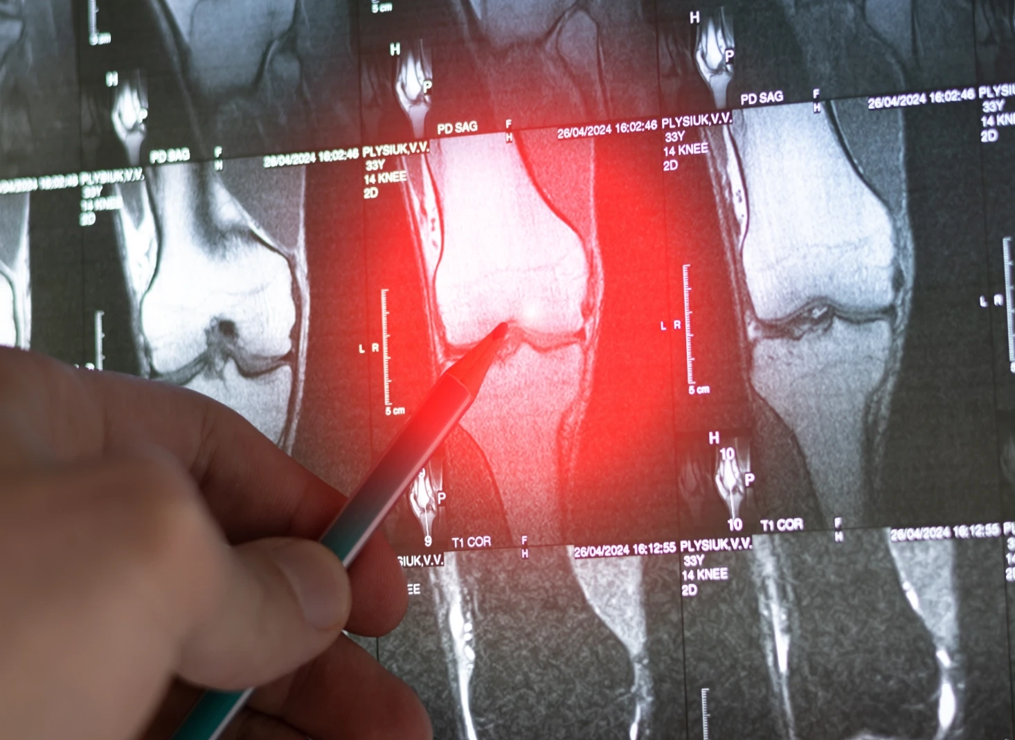 doctor pointing at knee