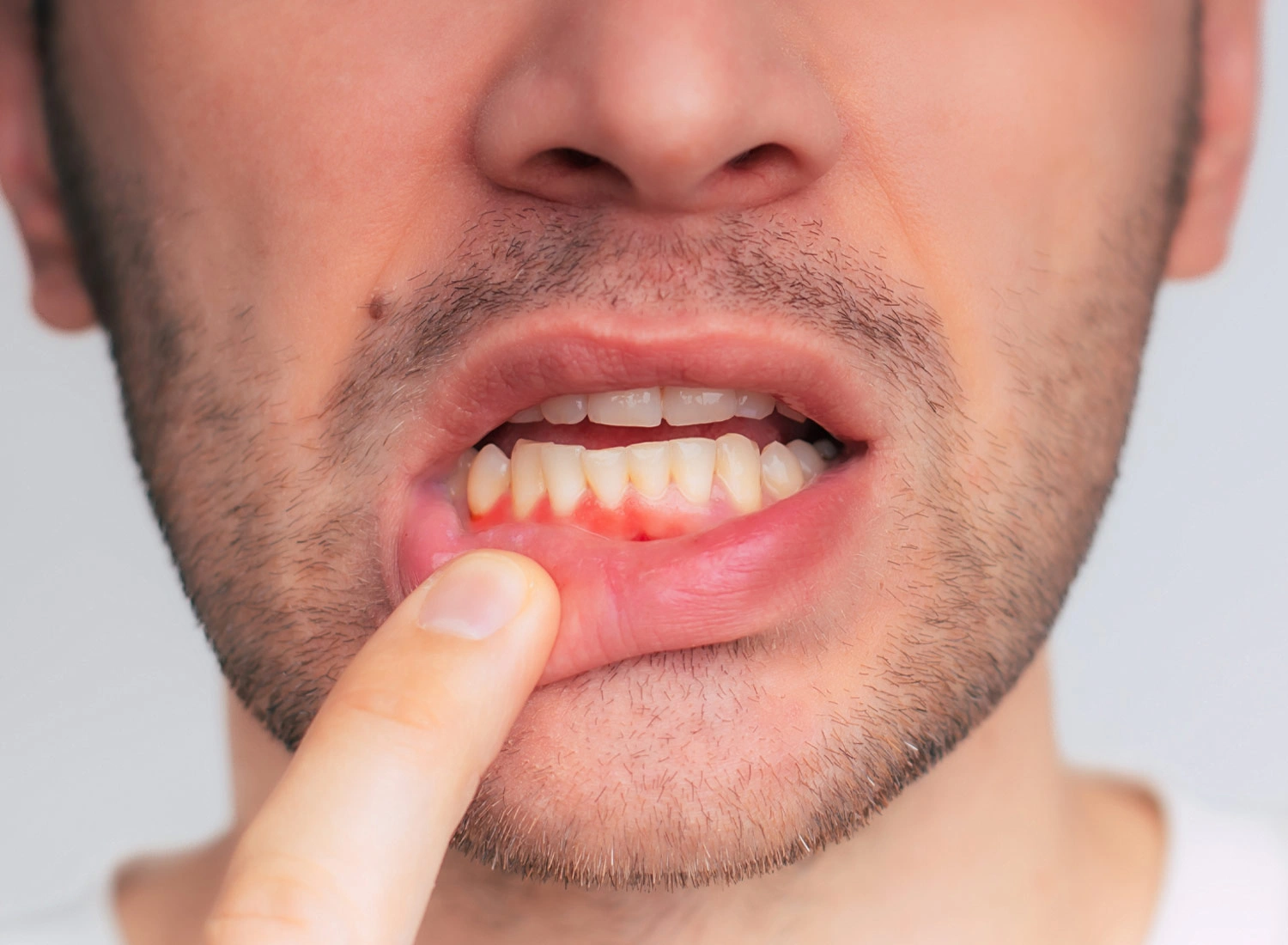 person pointing to gums