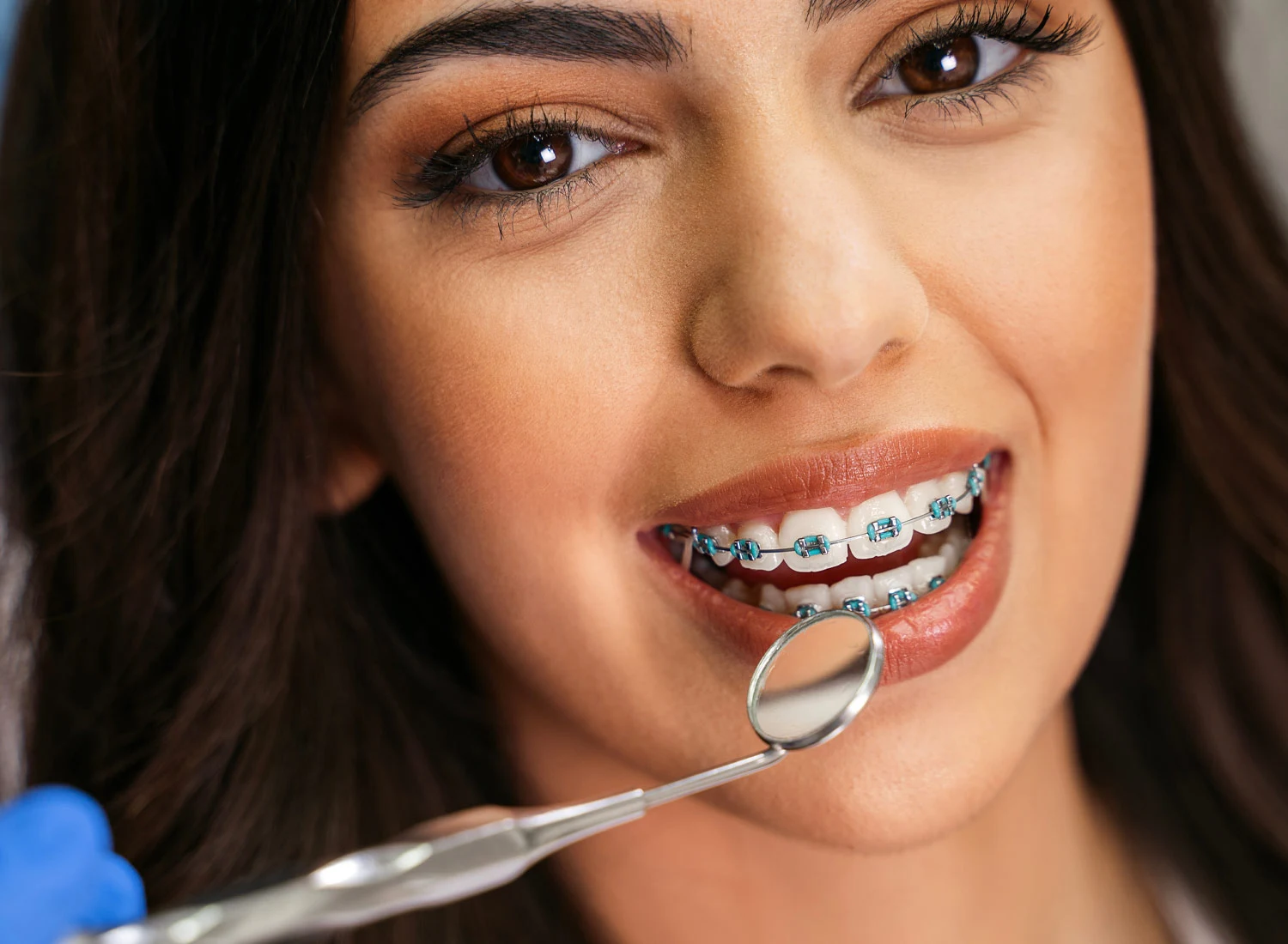 person with braces smiling