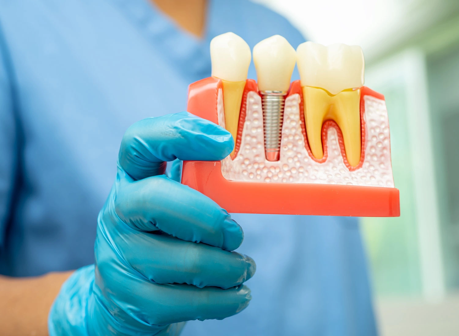 prosthodontic holding up model